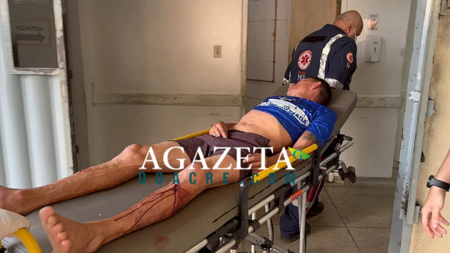 Homem Brutalmente Espancado por Facção em Galpão Abandonado em Rio Branco Imagem do artigo