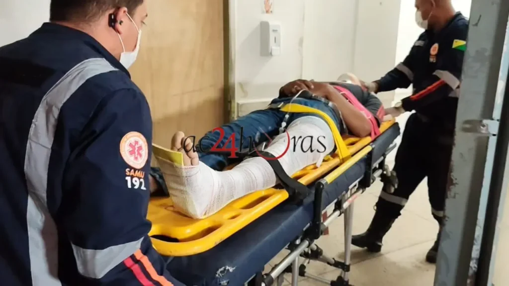 Motociclista Sofre Graves Fraturas Após Acidente em Rio Branco