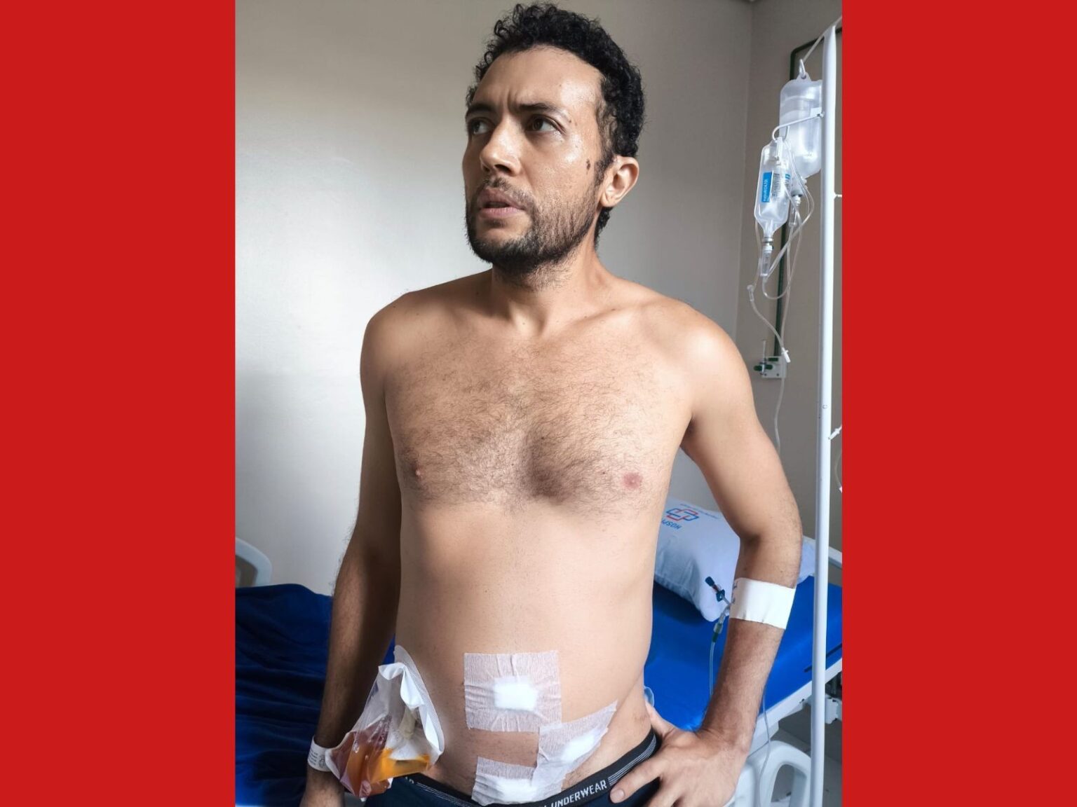 Professor de 36 anos enfrenta cirurgia de apendicite após diagnóstico inadequado; esposa denuncia ne