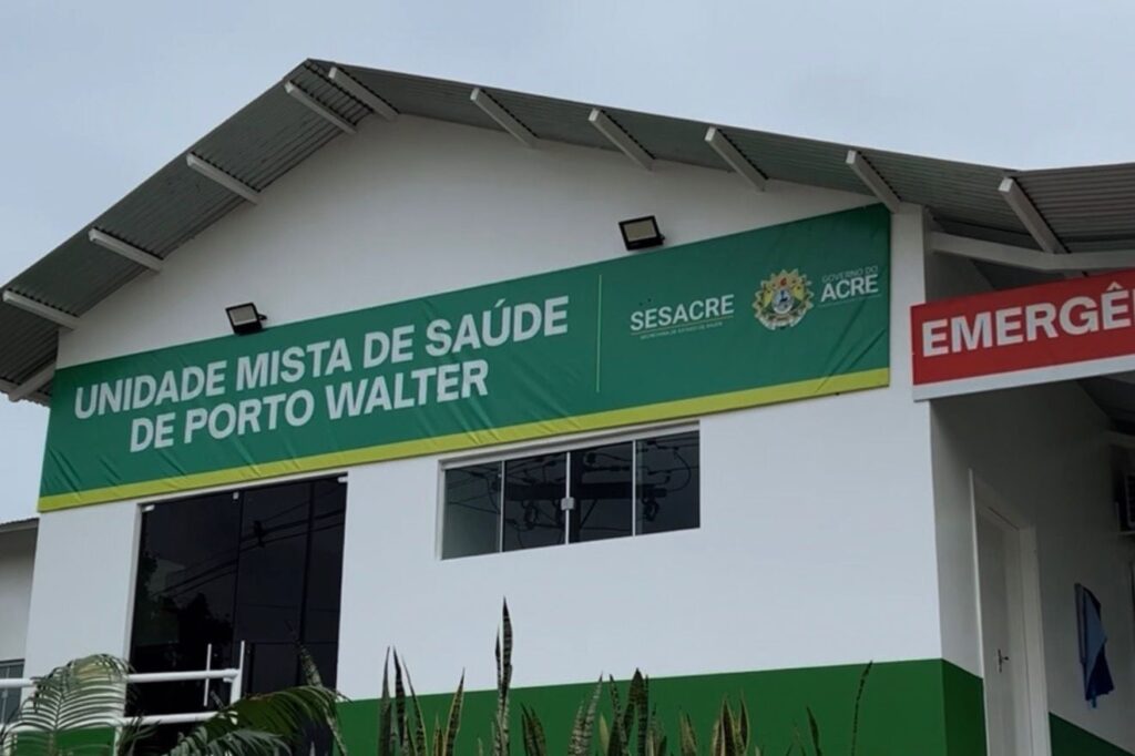 Avanço na Saúde Pública em Porto Walter: Raio-X Modernizado Já em Uso