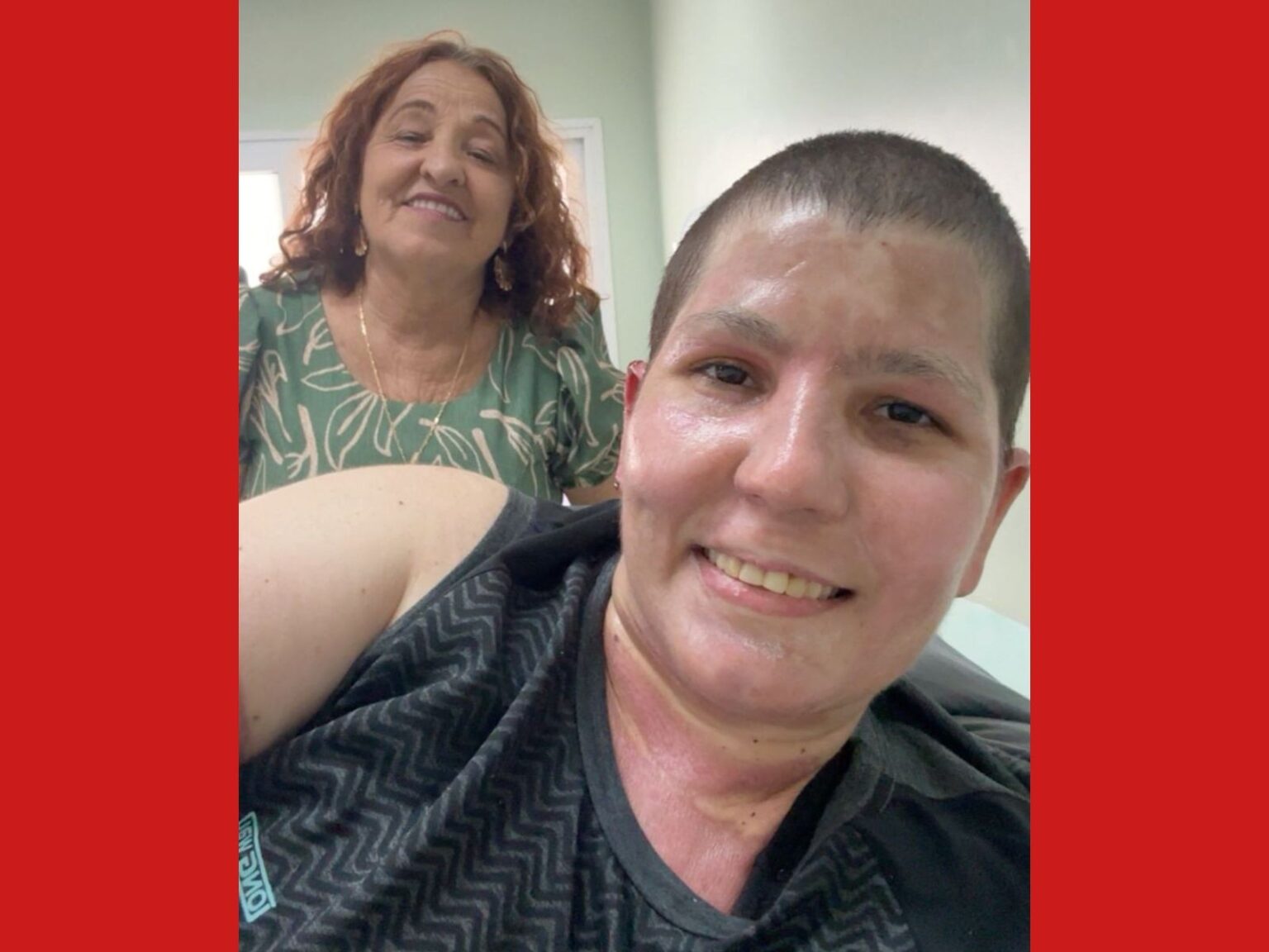 Mulher Que Sofreu Queimaduras Extensas Recebe Alta Após 30 Dias: ‘Uma Felicidade’ Mulher Que Sofreu Queimaduras Extensas Recebe Alta Após 30 Dias: 'Uma Felicidade'