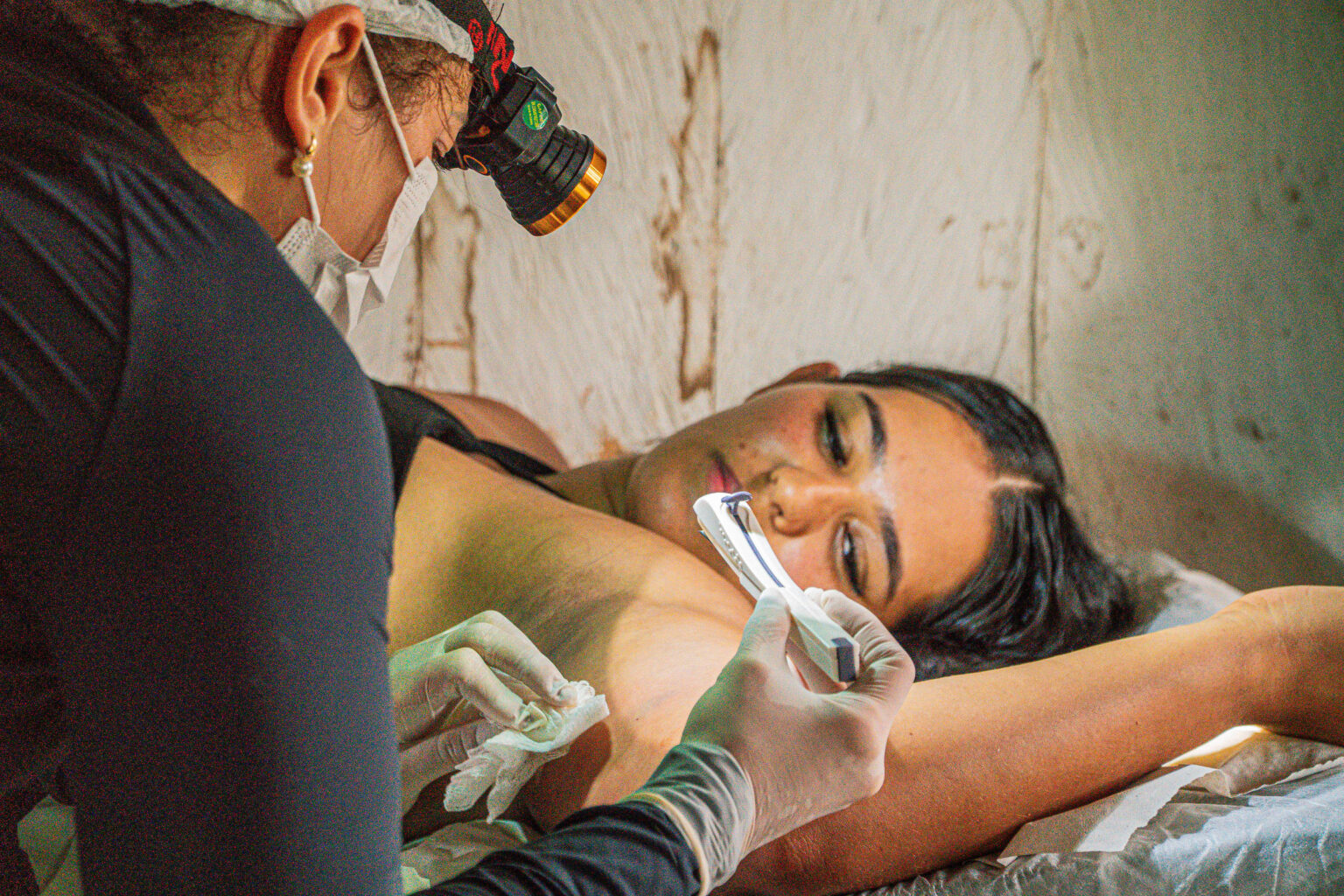 Implante Contraceptivo é Oferecido a Ribeirinhas no Acre: Uma Nova Esperança